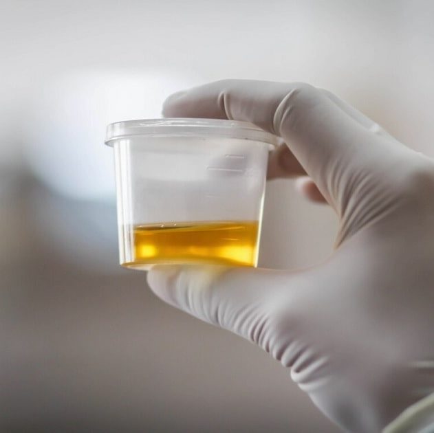 urine alcool