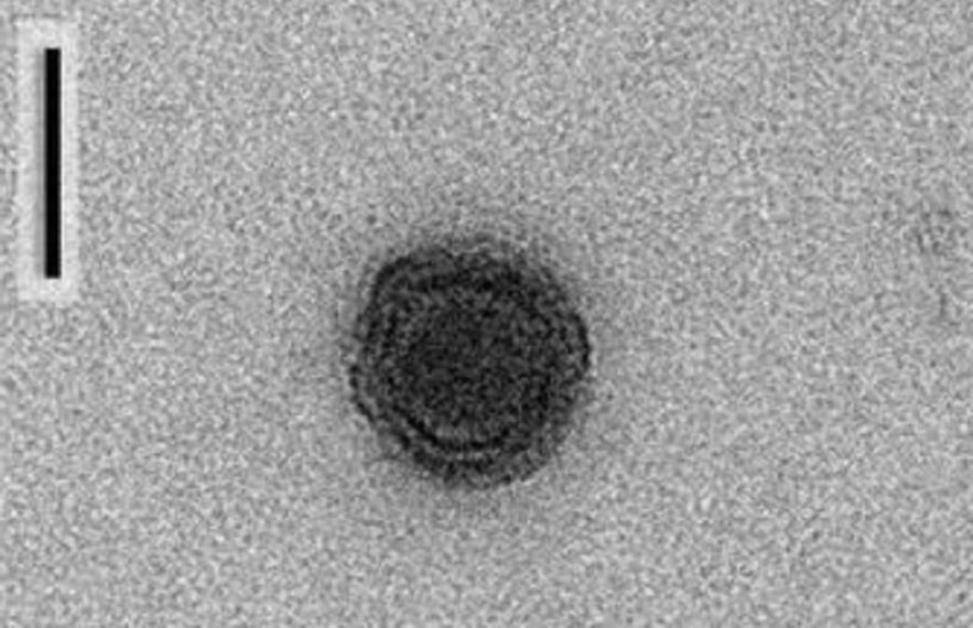 yaravirus microscope