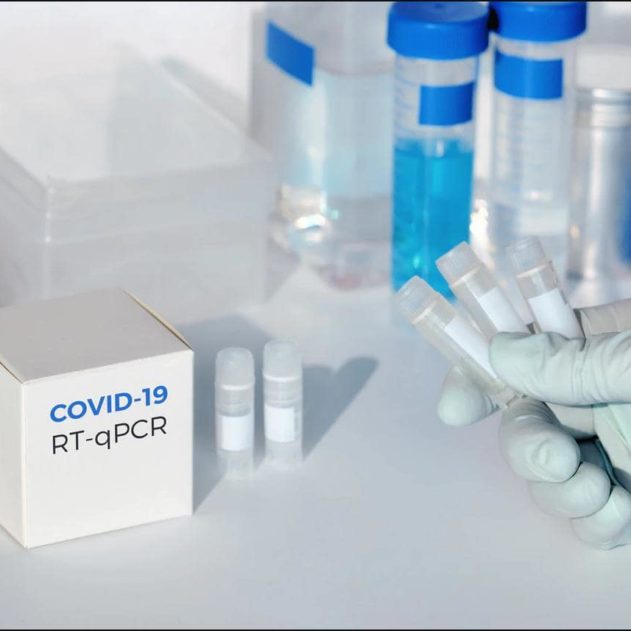 kit depistage rapide covid19