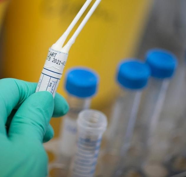 test coronavirus