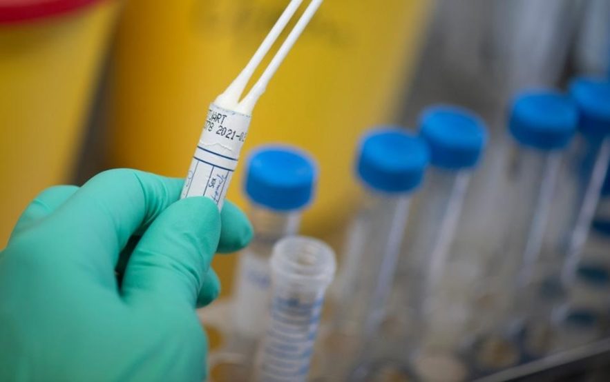 test coronavirus