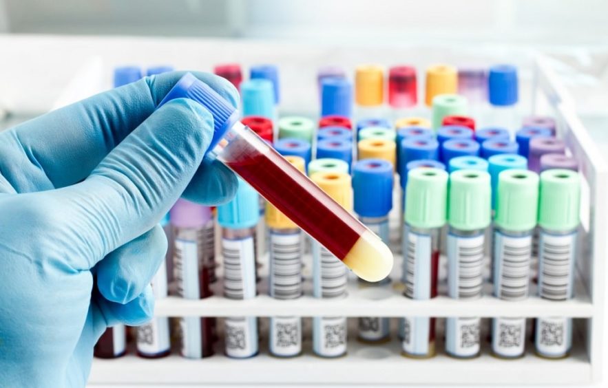 test coronavirus
