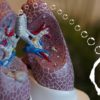 asthme inhalation siARN