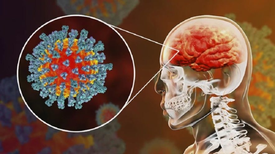 cerveau coronavirus