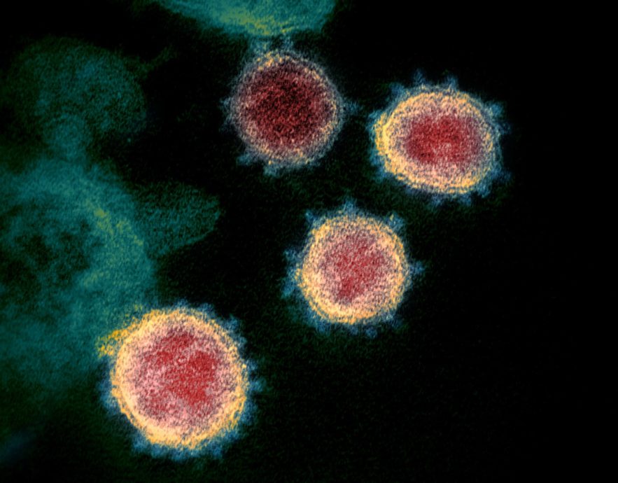liaison forte coronavirus récepteur humain