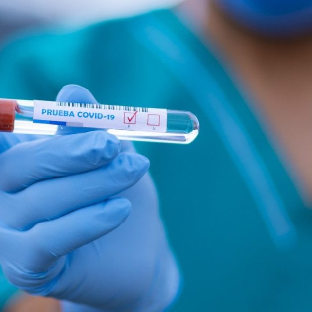 test traitement antiacide covid19