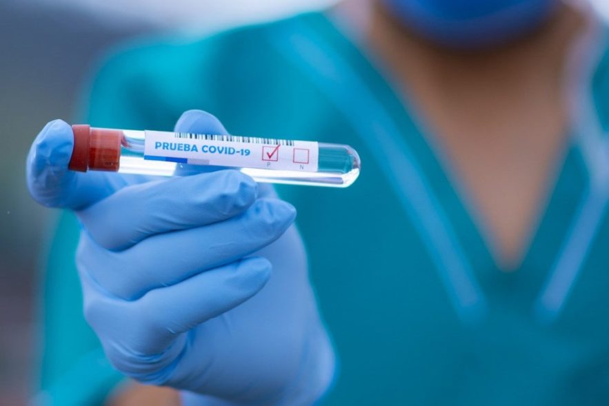 test traitement antiacide covid19