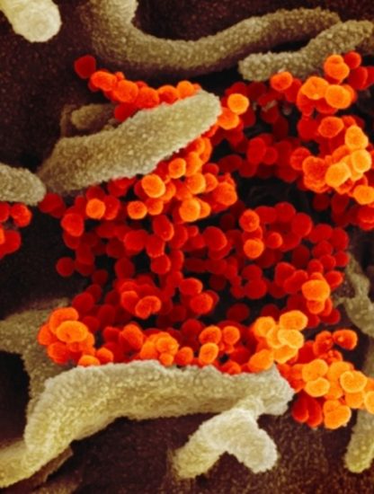 sars cov 2 coronavirus covid-19