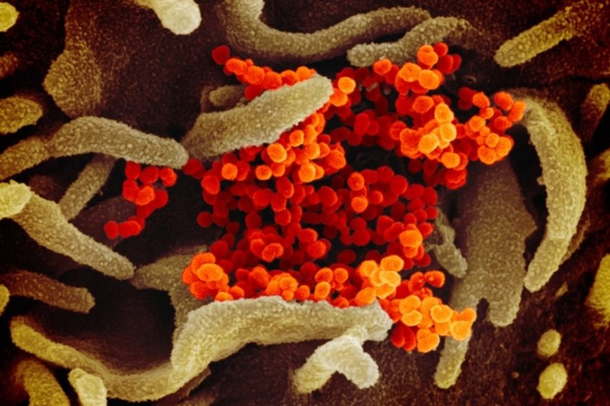 sars cov 2 coronavirus covid-19