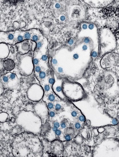 coronavirus sars cov 2 covid19