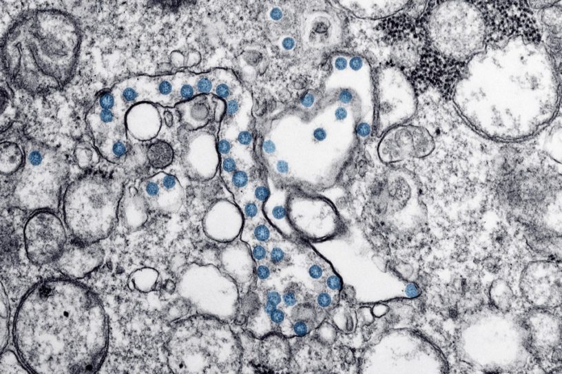 coronavirus sars cov 2 covid19