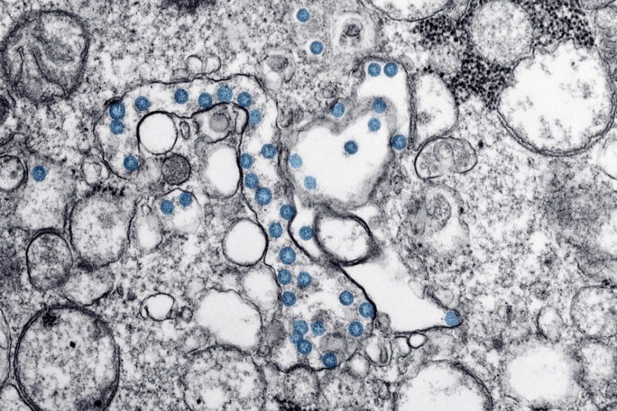 coronavirus sars cov 2 covid19