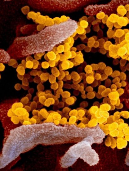 coronavirus covid-19 sars-cov-2 confinement pandémie