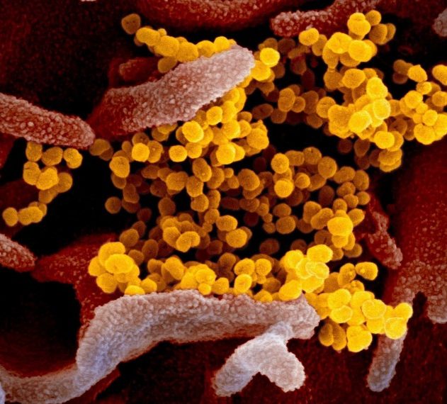 coronavirus covid-19 sars-cov-2 confinement pandémie