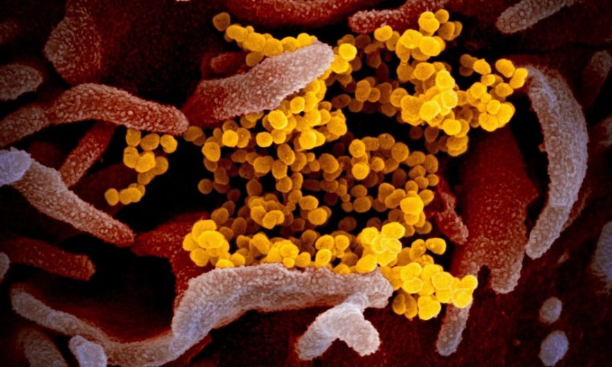 coronavirus covid-19 sars-cov-2 confinement pandémie