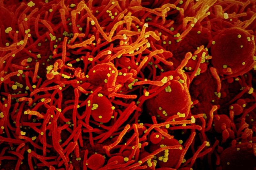 inhibiteurs métabolisme protéines blocage réplication virus