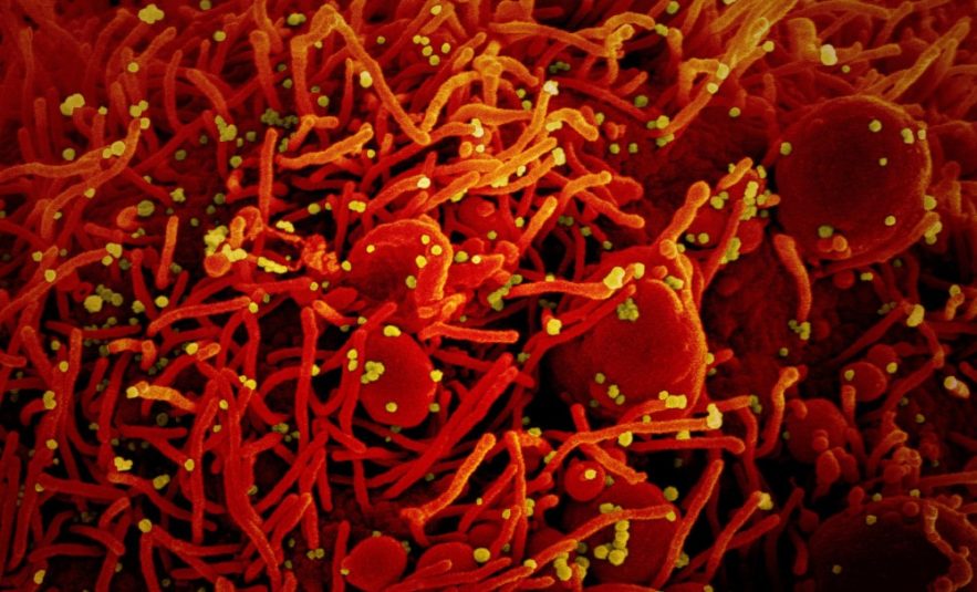 inhibiteurs métabolisme protéines blocage réplication virus