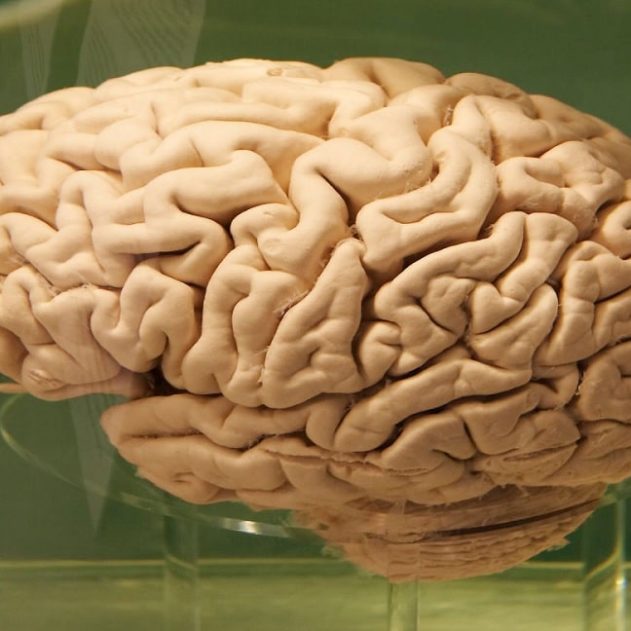 replis cerveau