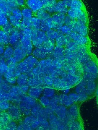 cancer sein modele murin culture cellules humaines