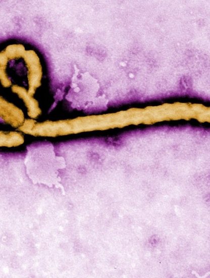 ebola virus