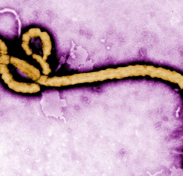 ebola virus