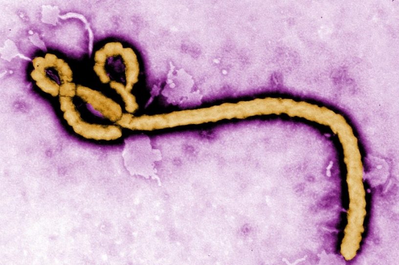 ebola virus