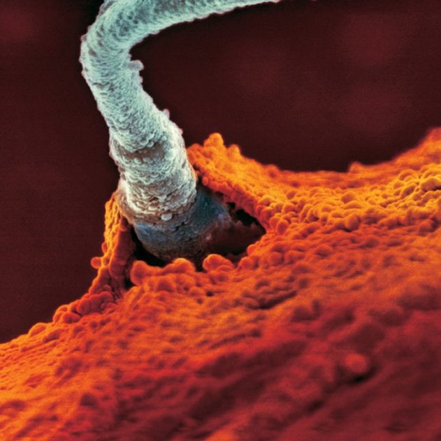 ovule sperme