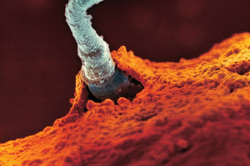 ovule sperme