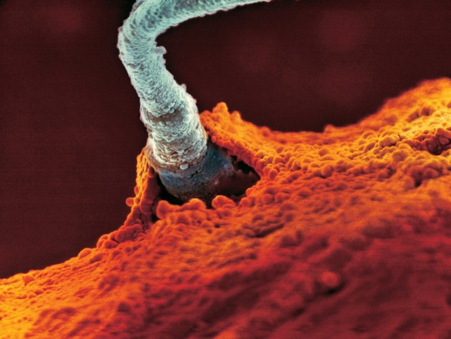 ovule sperme