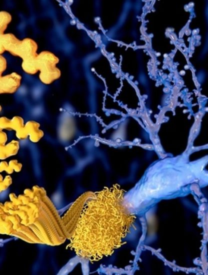 beta amyloide alzheimer maladie