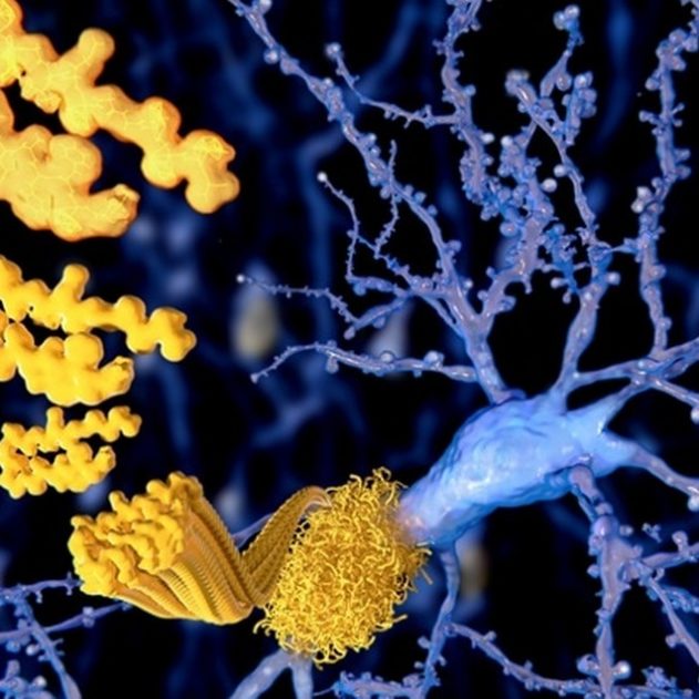 beta amyloide alzheimer maladie