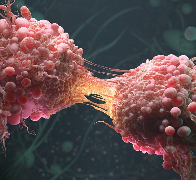 cellule cancereuse cancer acide gras