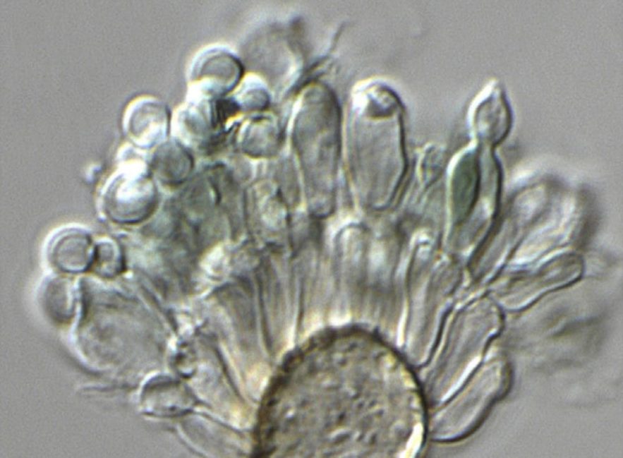 champignon hybride Aspergillus infections pulmonaires