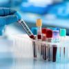 test sanguin sang cancer maladie detection diagnostic precoce rapide