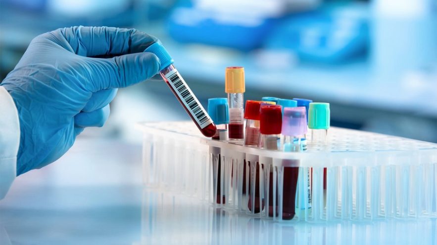 test sanguin sang cancer maladie detection diagnostic precoce rapide