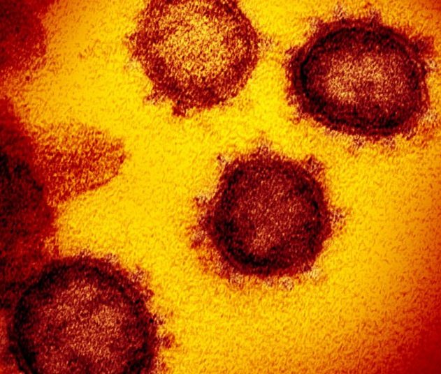 virus pandemie coronavirus sars-cov-2 covid-19