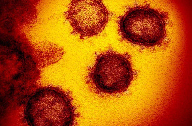 virus pandemie coronavirus sars-cov-2 covid-19