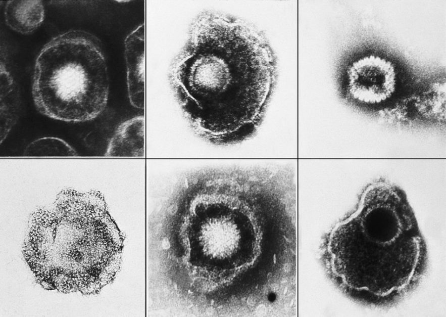 herpes virus