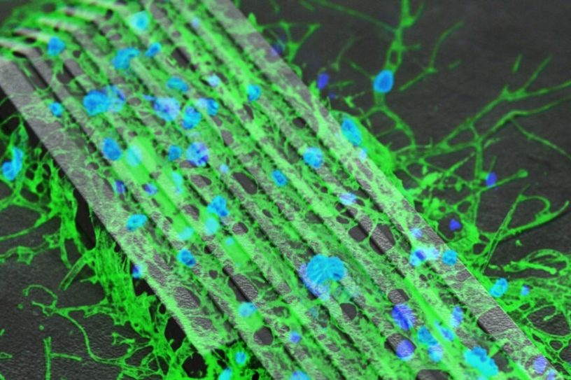 microrobots rétablissement communications entre cellules neurones