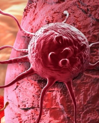 nouveau traitement expérimental détruit cellules cancéreuses sans médicament couv