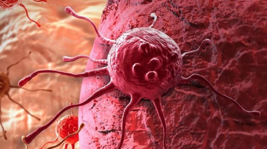 nouveau traitement expérimental détruit cellules cancéreuses sans médicament couv