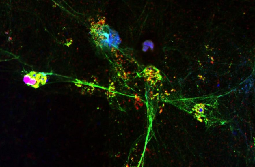 pièges extracellulaires neutrophiles