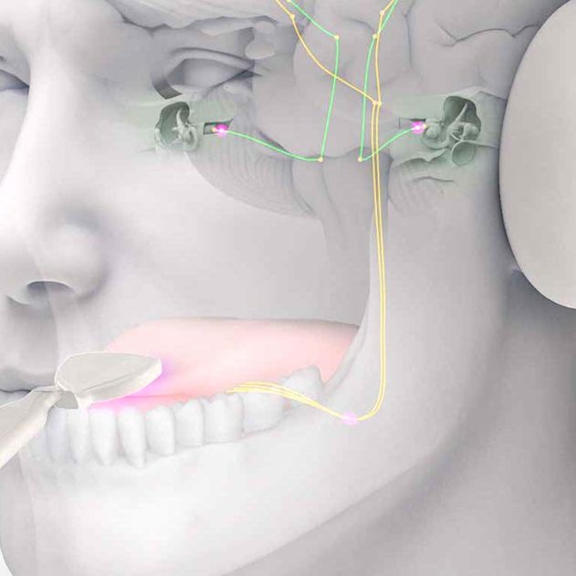 acouphenes traitement musique stimulations langue lenire
