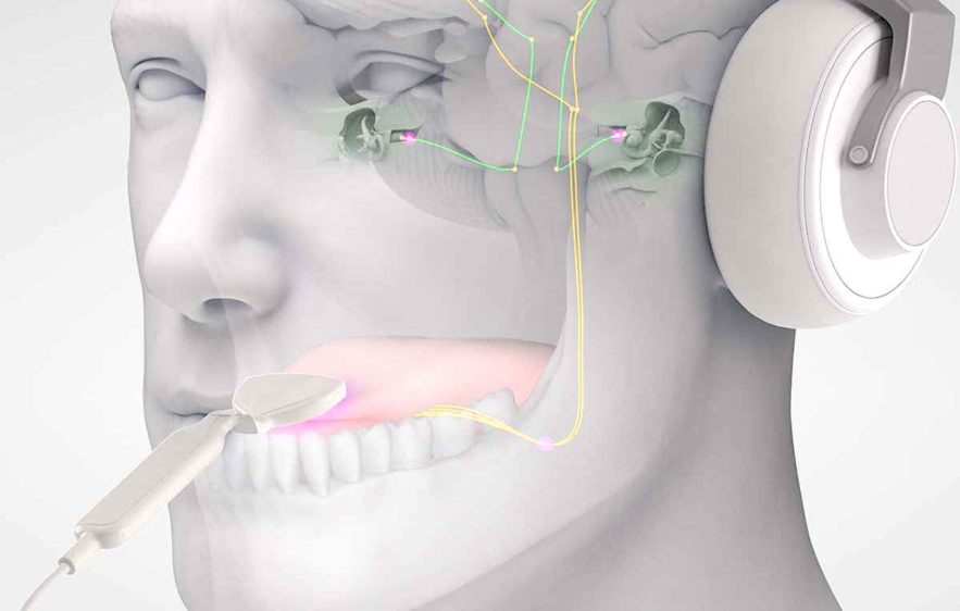 acouphenes traitement musique stimulations langue lenire