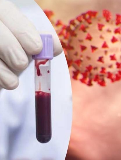 groupes sanguins impact sévérité risques infection coronavirus couv