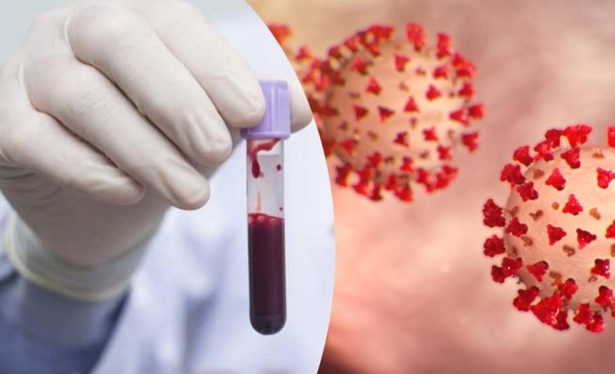 groupes sanguins impact sévérité risques infection coronavirus couv