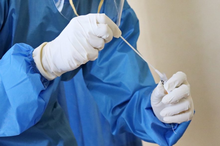 réinfections covid-19 immunité