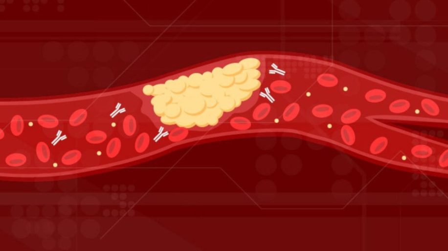 anticorps caillots sang coagulation covid-19