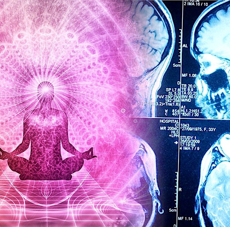 yoga renforce regions cerveau touchees par vieillissement