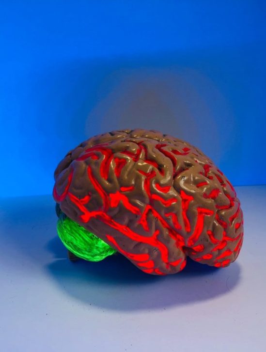 médicament traitement déclin cognitif